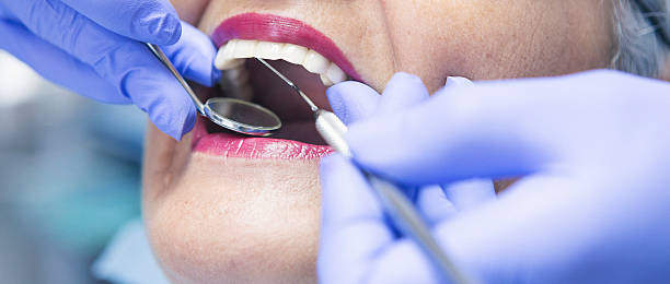 Best Emergency Wisdom Tooth Extraction in Ten Mile Run, NJ